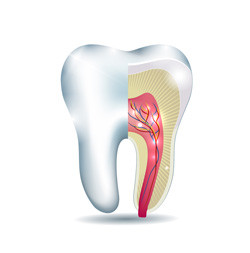 Root Canal